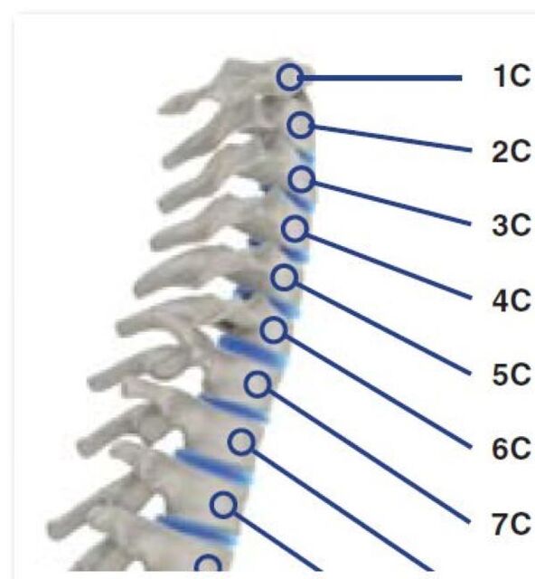 Sindrome di Rook