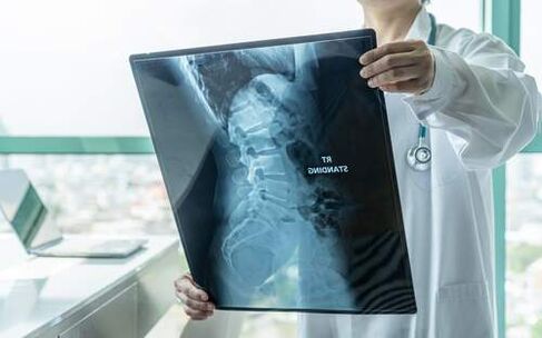 La radiografia è un metodo diagnostico necessario se la schiena fa male